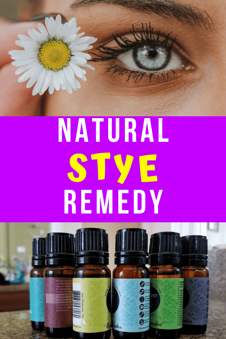 Natural Stye Remedy