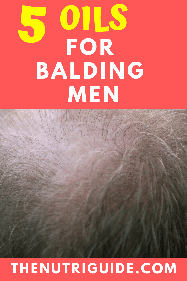 essential oils for balding men