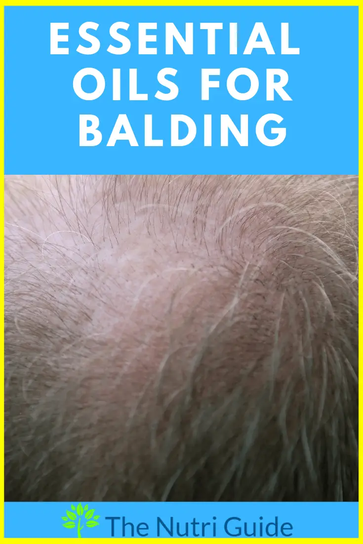 essential oils for balding