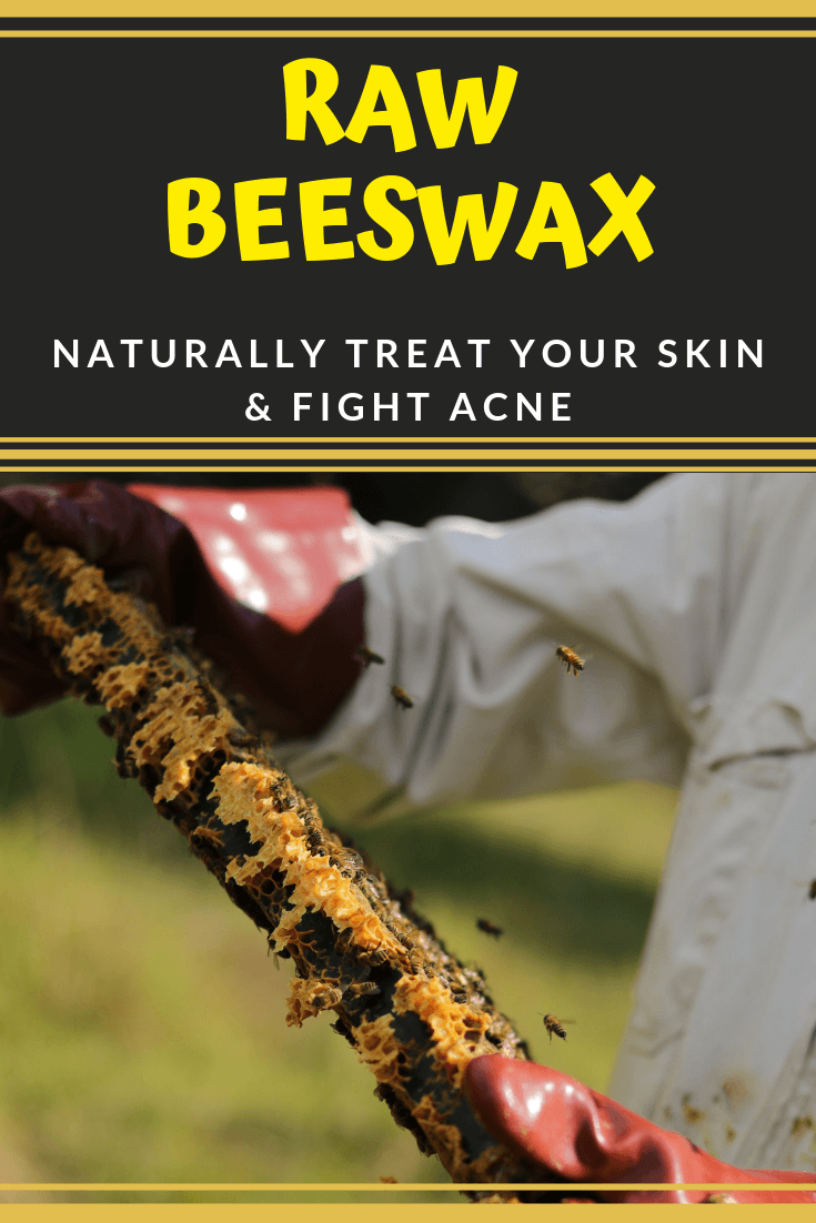 Raw Beeswax for Acne & Skin Treat Your Face Naturally