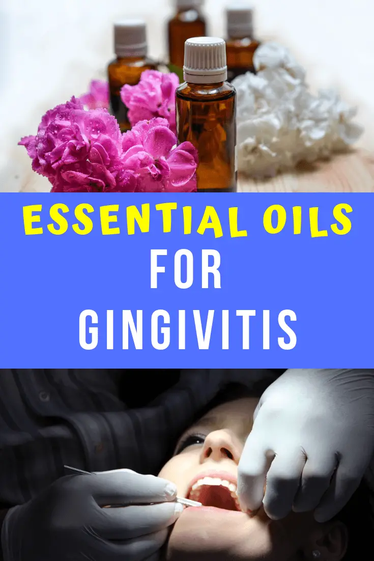 essential oils for gingivitis