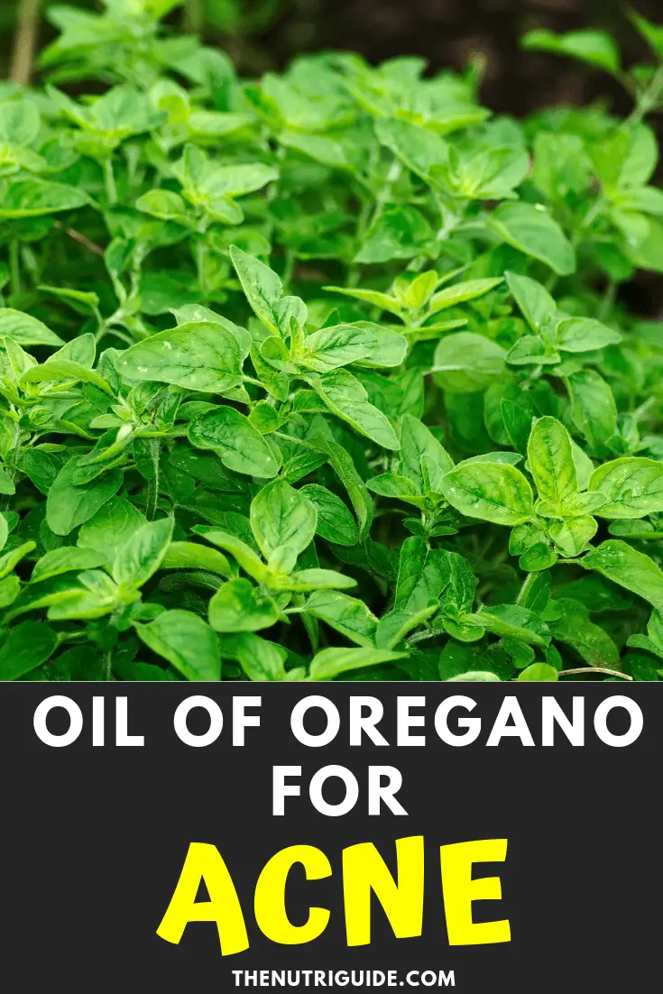 oil of oregano for acne