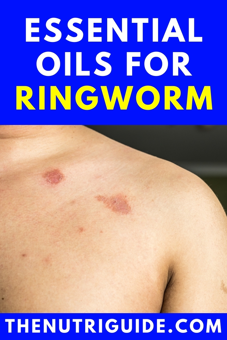 Essential oils for ringworm 2