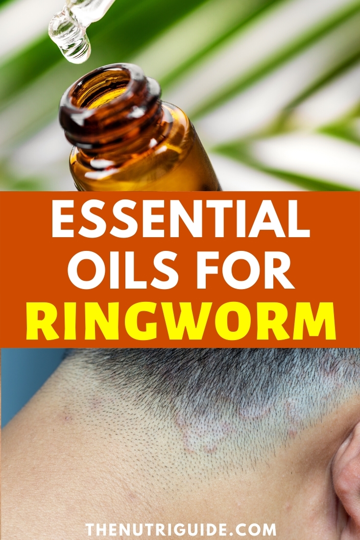 Essential oils for ringworm