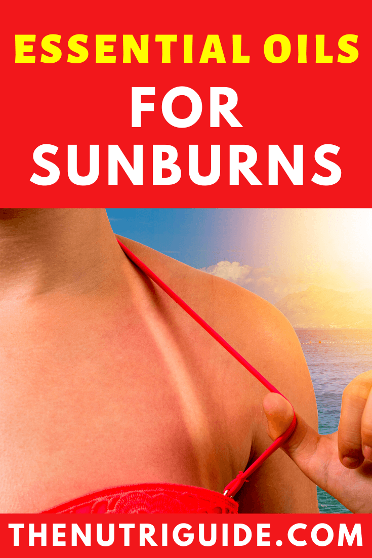 Essential Oils for Sunburns